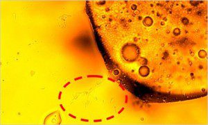 bacteria-blogSpan